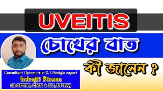 Uveitis কি চোখের বাত কি Treatment of Uveitis  Iritis  CHOROIDITIS  Panuveitis [upl. by Lynelle]