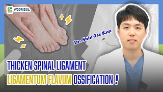 ligamentum flavum ossification [upl. by Maxentia]