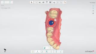 3Shape TRIOS Implant restoration workflow IT [upl. by Alemac]