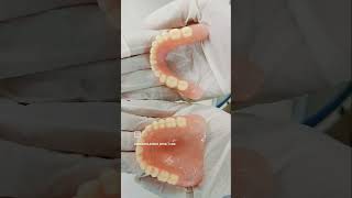 Complete denture restoring old smiles removable [upl. by Mowbray]