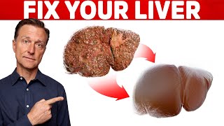 The 6 Best Ways to Heal a Fatty Liver [upl. by Avron95]