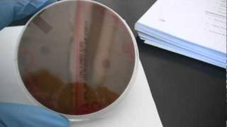 BIO 2192 UNIT 11  Strep Hemolysis Reactions on Blood Agar [upl. by Atsirc]