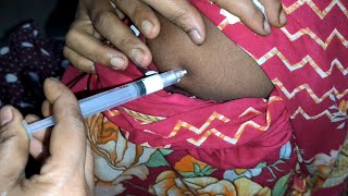 Arm IM Soma Ject Injection Push √√ Injection Videoজন্মবিরতিকরণ ইনজেকশন Ep 45 Injection Vision [upl. by Skilken]