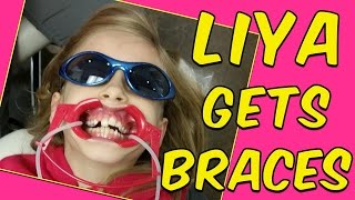 Liya Gets BRACES On The Stashies [upl. by Carver]