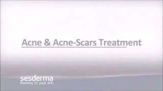 Mediderma Acne amp Acne Scar Treatment On ClickOnCare [upl. by Gnak]