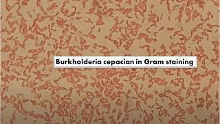 Burkholderia cepacia in Gram Staining of Culture Mag4000X [upl. by Edlun]