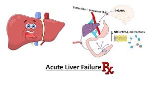 Acute Liver Failure Management [upl. by Shriver]