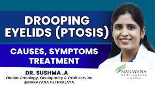 Drooping Eyelids Ptosis Know its Causes Symptoms and Treatment Kannada [upl. by Aiuqet]