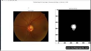 Eye Disease Detection using Machine Learning  IEEE Projects for CSE [upl. by Bucella306]