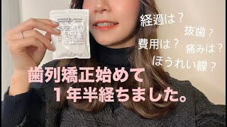 【歯列矯正】歯列矯正を始めて１年半経ちました🦷🪥激痩せしてほうれい線ができた事など赤裸々に語っています🗣 [upl. by Om688]