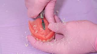 SOFRELINER TOUGH® Tips amp Tricks – Preparing the Denture Surface [upl. by Vitalis335]