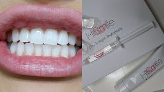 Hi Smile Teeth Whitening amp Toothpaste Review [upl. by Llerrut]