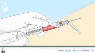 Laborgemeinschaft Bielefeld  Die Blutentnahme mit Hilfe des Aspirationssystems [upl. by Alvord]