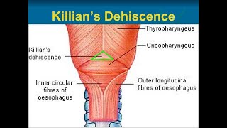 Anatomy of the Killians dehiscence  Pharyngeal dimple  Killians triangle  Killian laimers [upl. by Fran192]