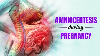 Amniocentesis during Pregnancy  What is it used for and its benefits  3D Guide [upl. by Lilak563]