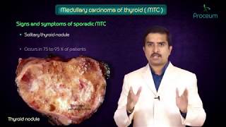 Thyroid neoplasms part 3  Medullary carcinoma of thyroid   Endocrine pathology [upl. by Fridell]