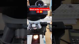 💩 Stool microscopic examination  Stool RE Test  Stool under Microscope [upl. by Curran132]