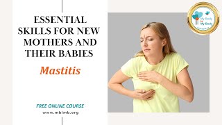 Breastfeeding Mastitis  ESSENTIAL SKILLS FOR NEWMOTHERS AND THEIR BABIES [upl. by Jeannine]