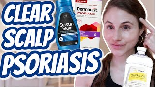 How to CLEAR SCALP PSORIASIS Dr Dray [upl. by Yenhoj]