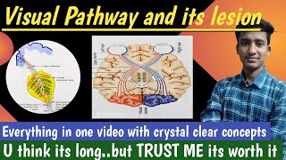 Visual Pathway  and its lesion  Special Senses Physiology  in hindi Ashish Agrawal [upl. by Eresed]