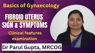 Uterine Fibroid  Sign amp Symptoms  Clinical features [upl. by Kellyn769]