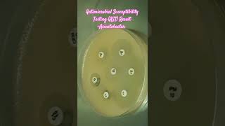 Antibiotics Sensitivity Testing AST of Acinetobacter baumannii complex microbiology microbes [upl. by Scheider]