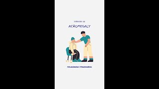 Acromegaly [upl. by Nahpos]