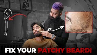 How To Fix Patchy Beard  Patchy Beard Hacks  Beard Growth  Grooming Masterclass EP 2 [upl. by Checani]