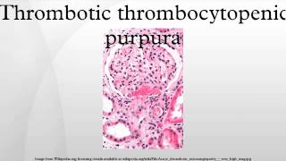 Thrombotic thrombocytopenic purpura [upl. by Rox]