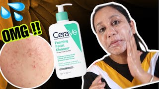 Cerave Foaming Cleanser For Oily Acne Prone Skin [upl. by Lubbock720]