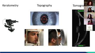 Using Corneal Topography to Enhance your Specialty Contact Lens Fitting [upl. by Emalee]