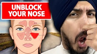 3 Steps to INSTANTLY Unblock Your Nose For Good [upl. by Nagaet]