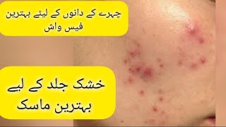 Acne Treatment at home  Chehray k daano ka best totka  Mask for dry Skin  blessed kitchen [upl. by Herminia]