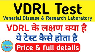 VDRL टेस्ट क्या होता है  VDRL test in hindi  Venerial Disease Research Laboratory Test [upl. by Deck745]