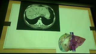 Reseccion Hepática y Pancreática  TECNICAS QUIRURGICAS [upl. by Arev]