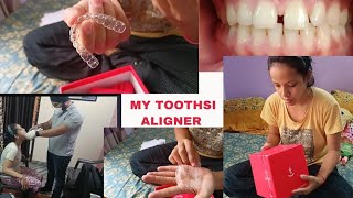 My Toothsi Aligner Day 1Unboxing of Toothsi AlignerBraces Precaution in IndiaToothsi [upl. by Rochella]