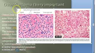 Pathology 828 a OsteoSarcoma OsteoGenic Bone Tumor Metaphysis Malignancy surface [upl. by Thorley]