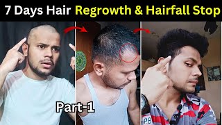 Hair Regrowth amp Hairfall Stop 7 Days Series  Day  1  Dhru Rao [upl. by Elehcar]