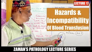 Hematology Lecture 17  Hazards amp Incompatibility of Blood Transfusion [upl. by Ydarb]