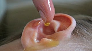 Natural Remedies for Ear Infection [upl. by Strander]