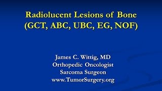 Orthopedic Oncology Course  Radiolucent Lesions of Bone GCT ABC UBC  Lecture 7 [upl. by Kelley]