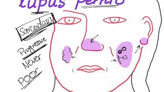 Lupus Pernio with a mnemonic [upl. by Lally421]