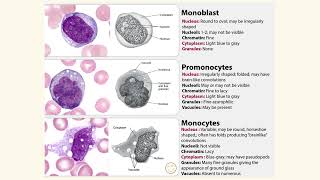 Medical Haematology  Monocyte maturation series monoblast vs promonocyte vs monocyte [upl. by Dygert991]