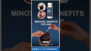 Minoxidil Hair Regrowth Results ytshorts shortsvideo minoxidil [upl. by Ely329]