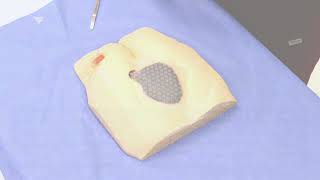 3M™ Dermatac™ Drape Sacral and Heel Wound Model Application Video [upl. by Nylirehc713]