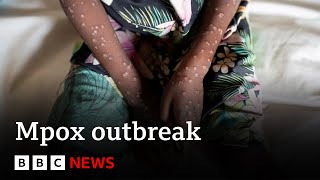 What is mpox and how is it spread  BBC News [upl. by Lesiram]