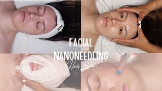 NANONEEDLING facial  10 STEPS  Relaxing music [upl. by Daukas429]