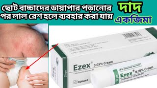 ezex cream এর কাজ কিদাদ একজিমা বাচ্চাদের ঘামাচির মত গোটা বা লাল রেশ হলে [upl. by Oiliruam82]