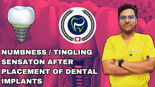 Dr Rudra Mohan  Neurosensory Disturbances After Dental Implant Placement  Numblness  Tingling [upl. by Handy]