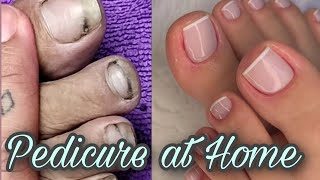 Pedicure at home Transformation from dirty to clean nails  Pedicure followingmydream [upl. by Stephen]